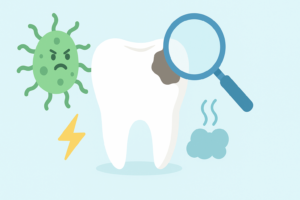 虫歯 の原因とは？原因菌から症状までわかりやすく解説